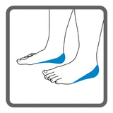 Illustration of left and right heels, with shading to highlight where Dermisplus Prevent should be placed