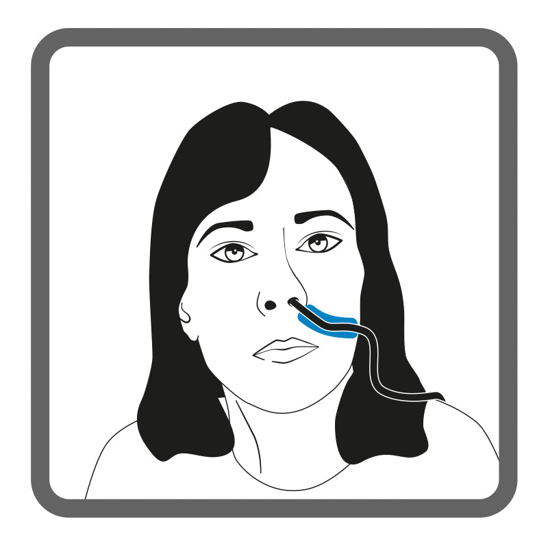 Illustration of a female face, with a nasal tube in the left nostril, with shading to show the placement of Dermisplus Prevent strip.
