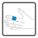 Illustration of a left hand, with shading to show the placement of Dermisplus Prevent strip, wrapped around the index finger. 